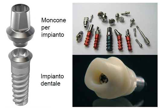 Monocone per impianti